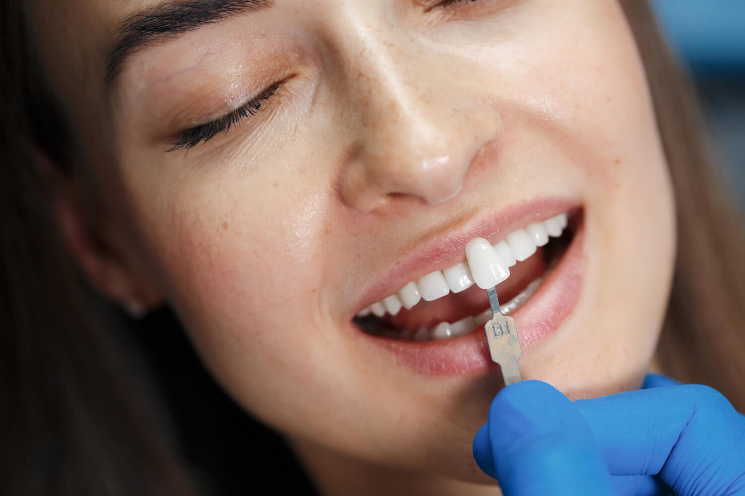 Paciente sorridente comparando escala de cor B1 da lente de contato dental em atendimento na Saraiva Odontologia em Perdizes.